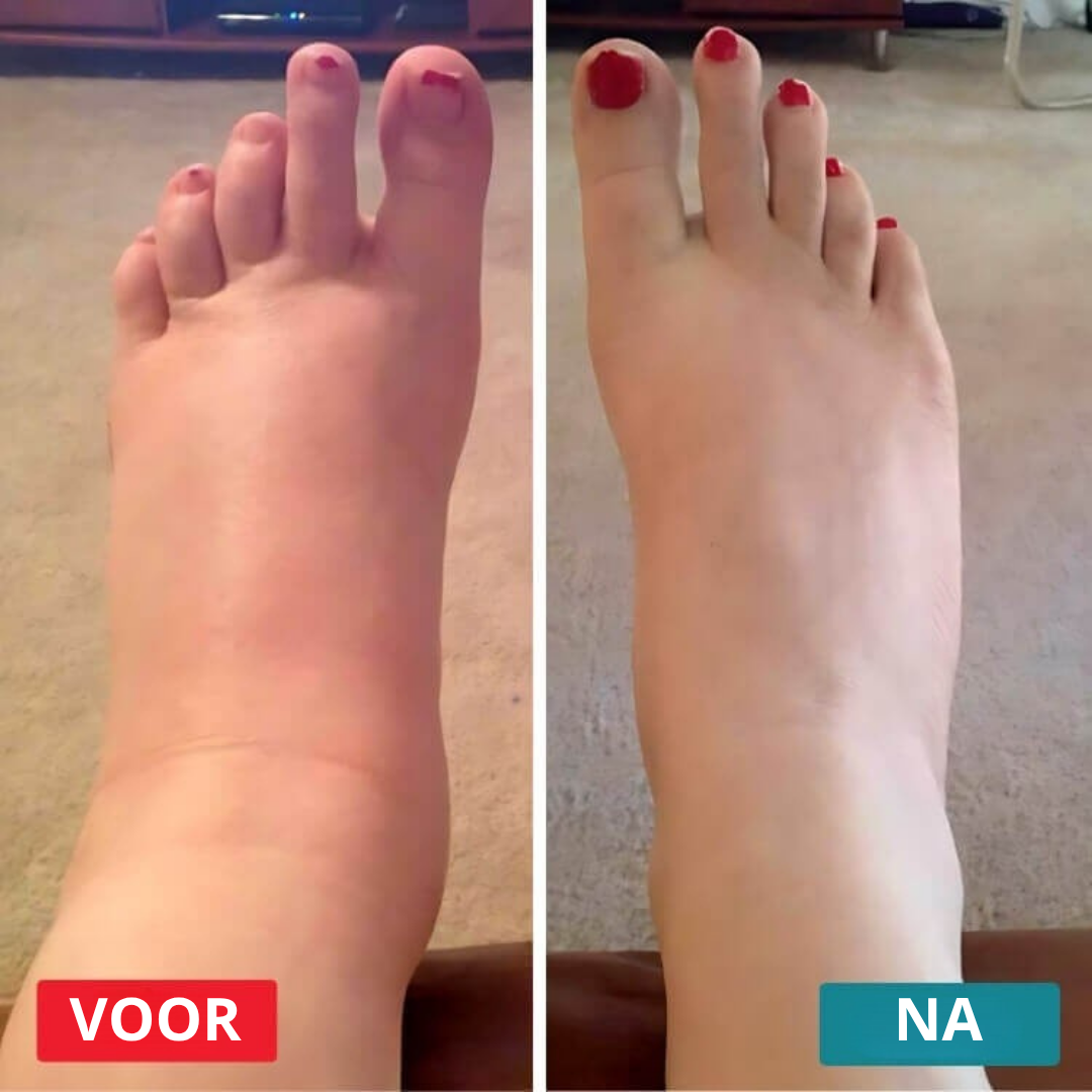 VitaSole NMES Mat - De Slimme voetmat tegen pijn - Nu 50% korting!