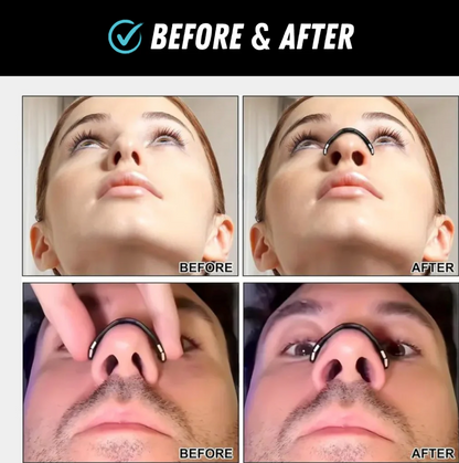 BreezUp™ - Magnetische neusstrips